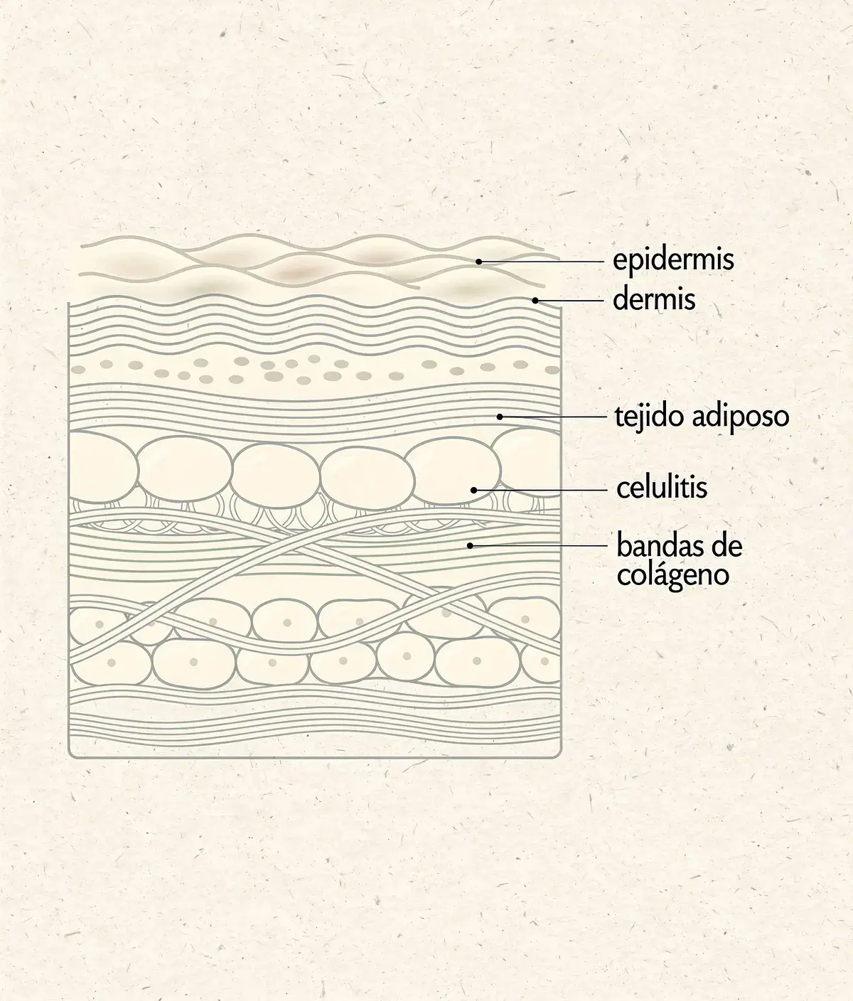 Infografía de la estructura de la piel y la celulitis en estilo técnico.